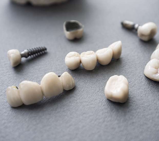 North Hollywood The Difference Between Dental Implants and Mini Dental Implants